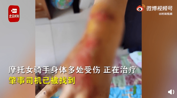 一名男子在直播中被恋童癖猎人发现死在M4上，“多处受伤”