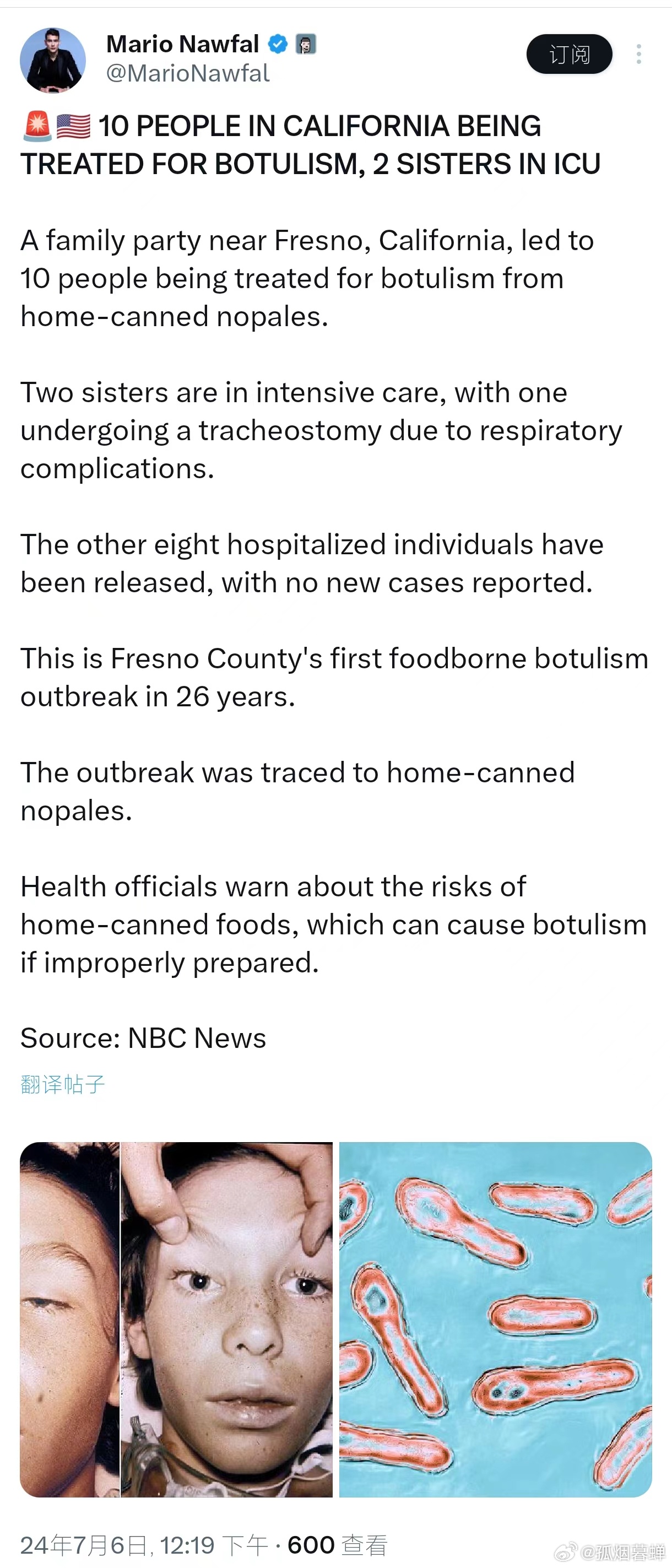 其中三人在吃了供应给NHS医院的甜点后死于严重的食物中毒